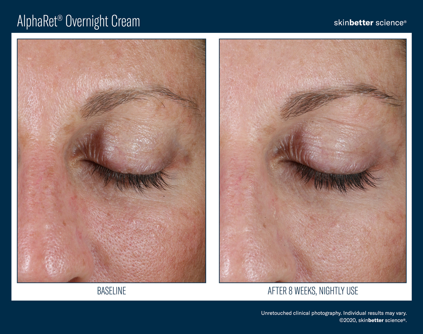 Skinbetter Science AlphaRet Overnight Cream
