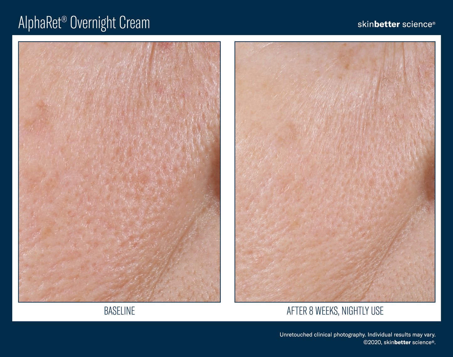 Skinbetter Science AlphaRet Overnight Cream