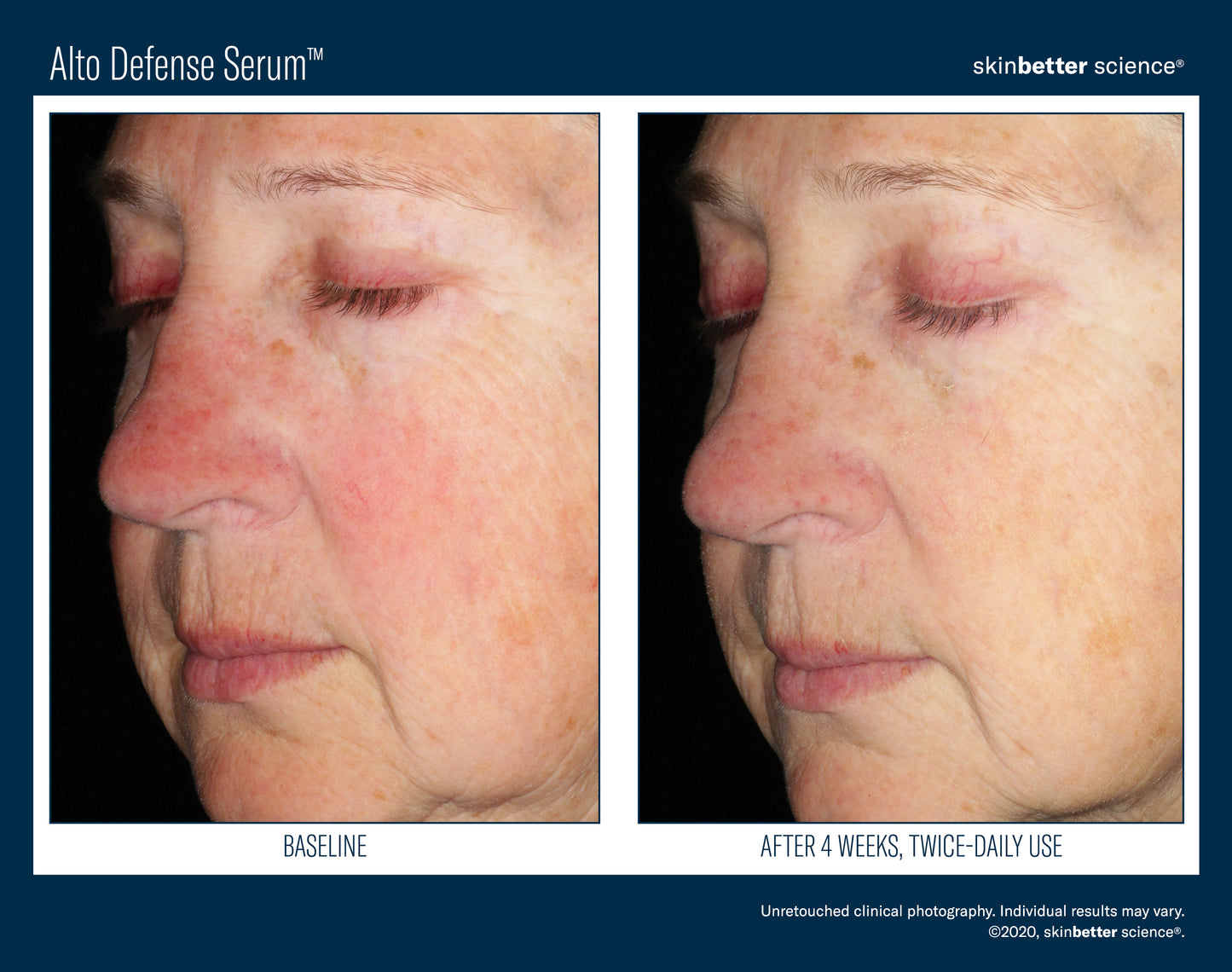 Skinbetter Science Alto Defense Serum (30ml)