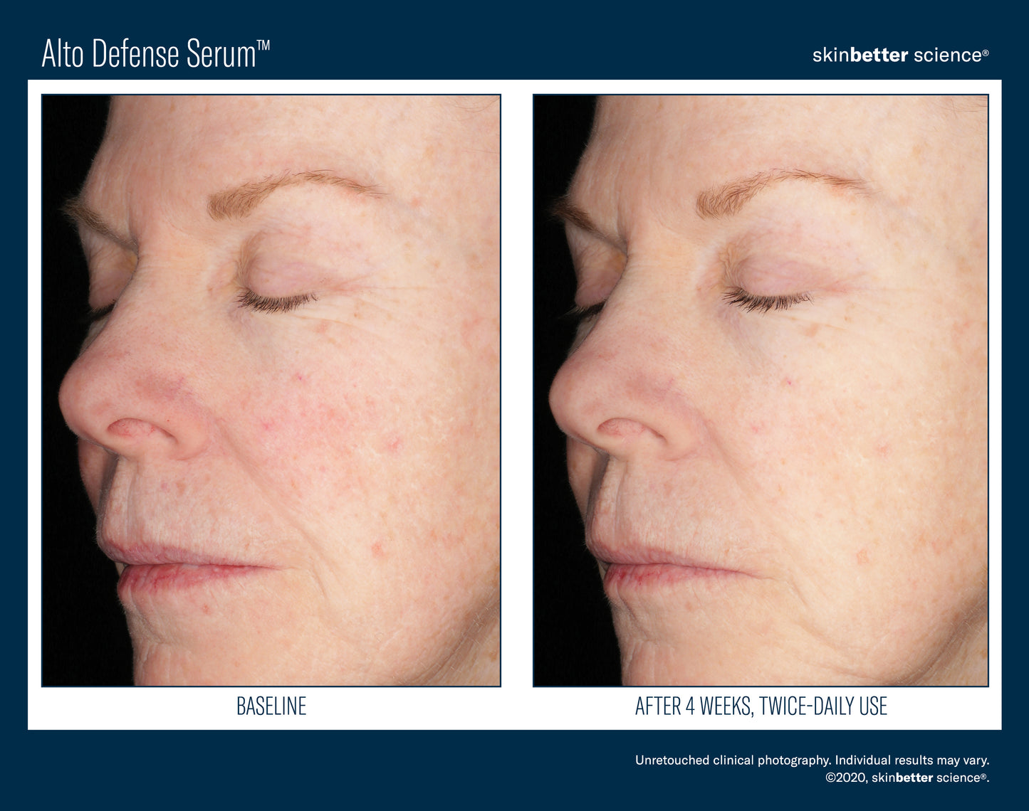 Skinbetter Science Alto Defense Serum (30ml)