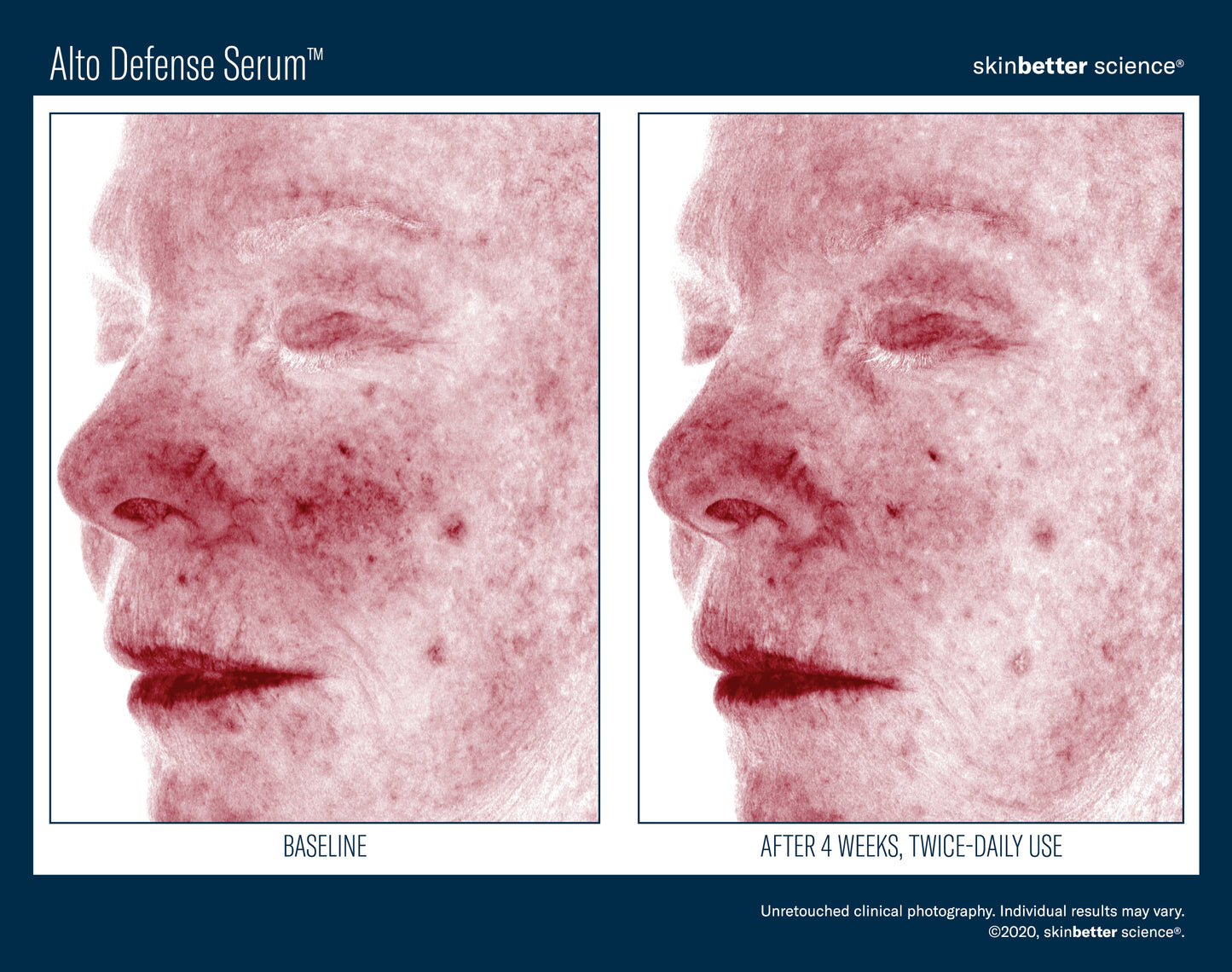 Skinbetter Science Alto Defense Serum (30ml)