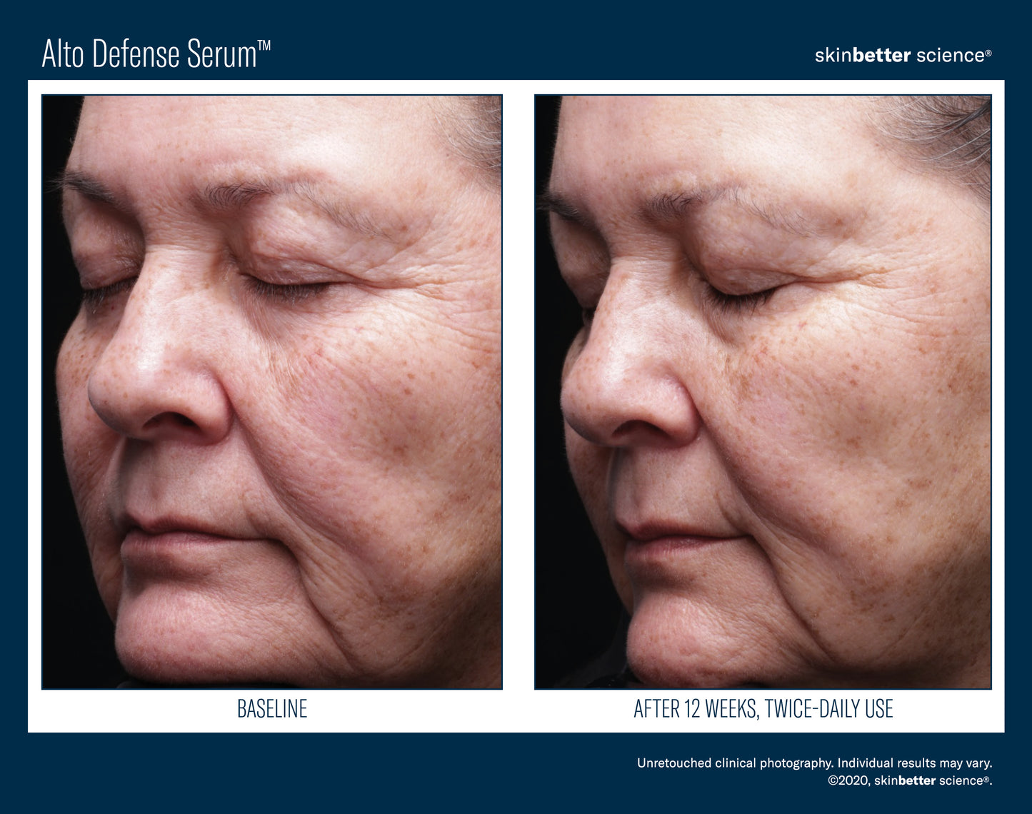 Skinbetter Science Alto Defense Serum (30ml)