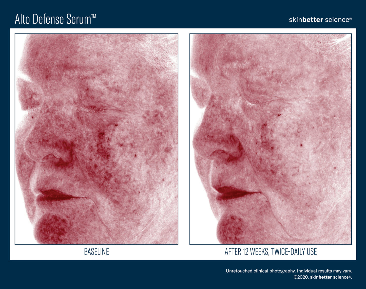Skinbetter Science Alto Defense Serum (30ml)
