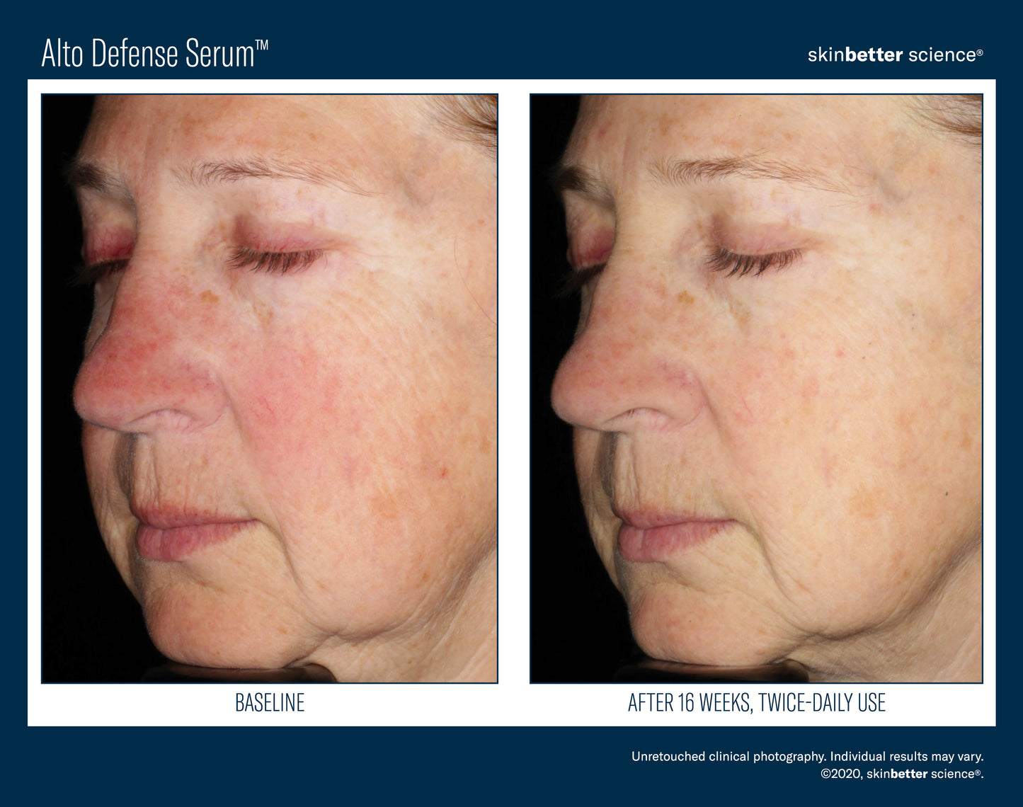 Skinbetter Science Alto Defense Serum (30ml)