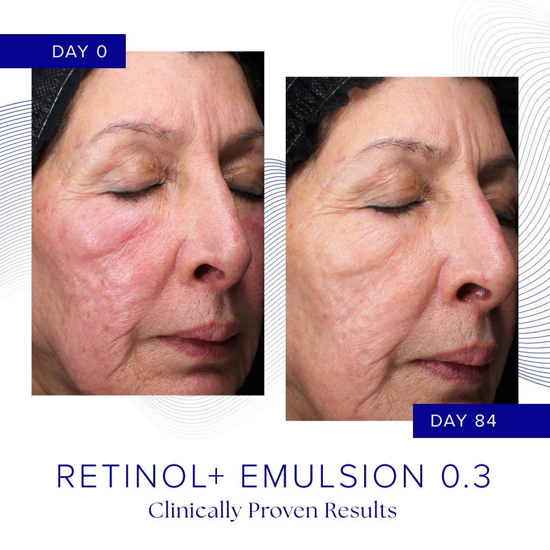 iS Clinical Retinol + Emulsion 0.3 (30g)