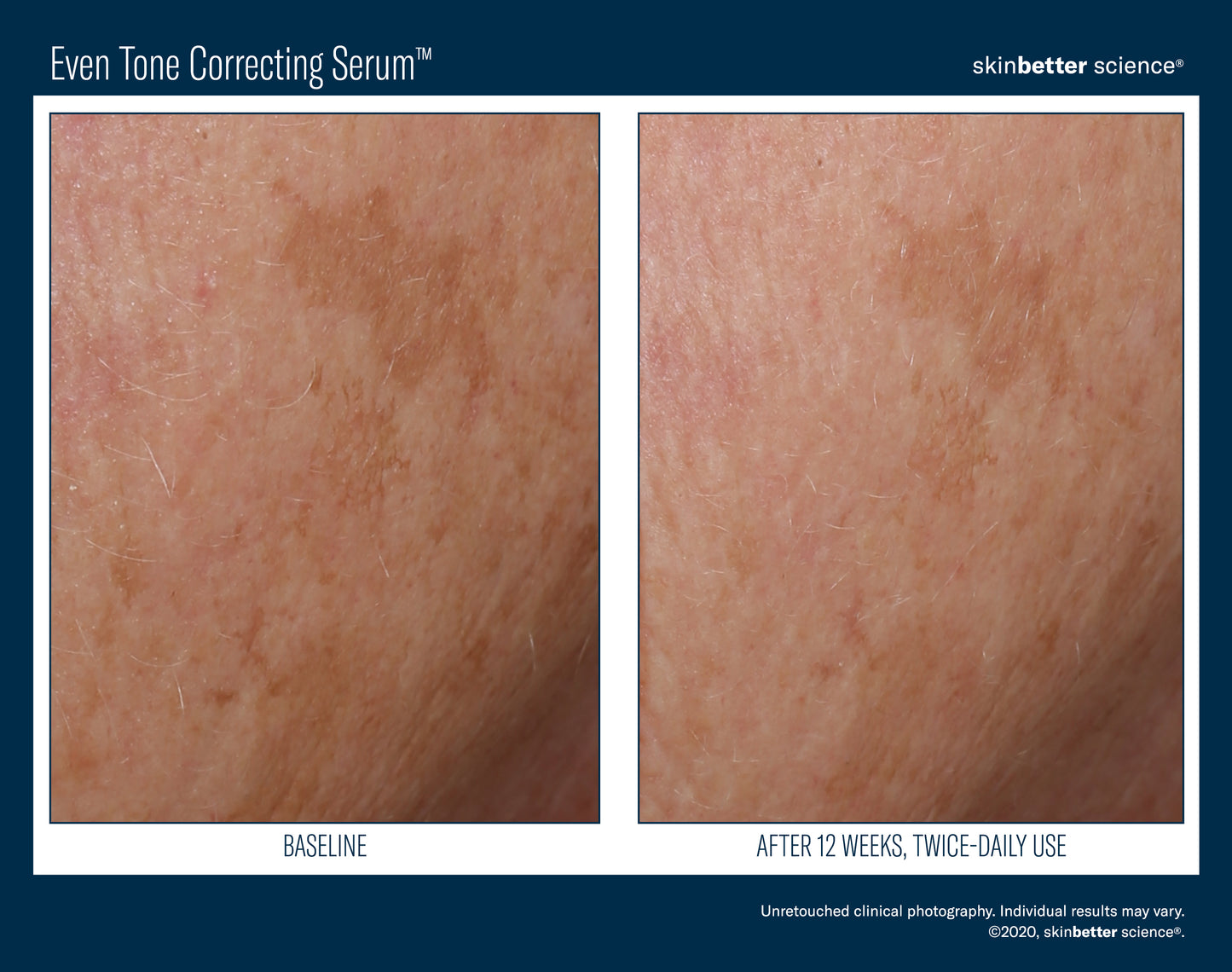 Skinbetter Science Even Tone Correcting Serum (50ml)