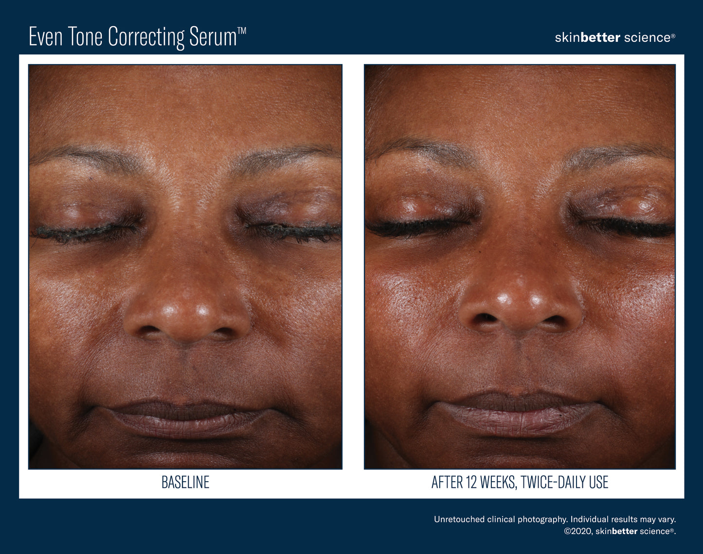 Skinbetter Science Even Tone Correcting Serum (50ml)