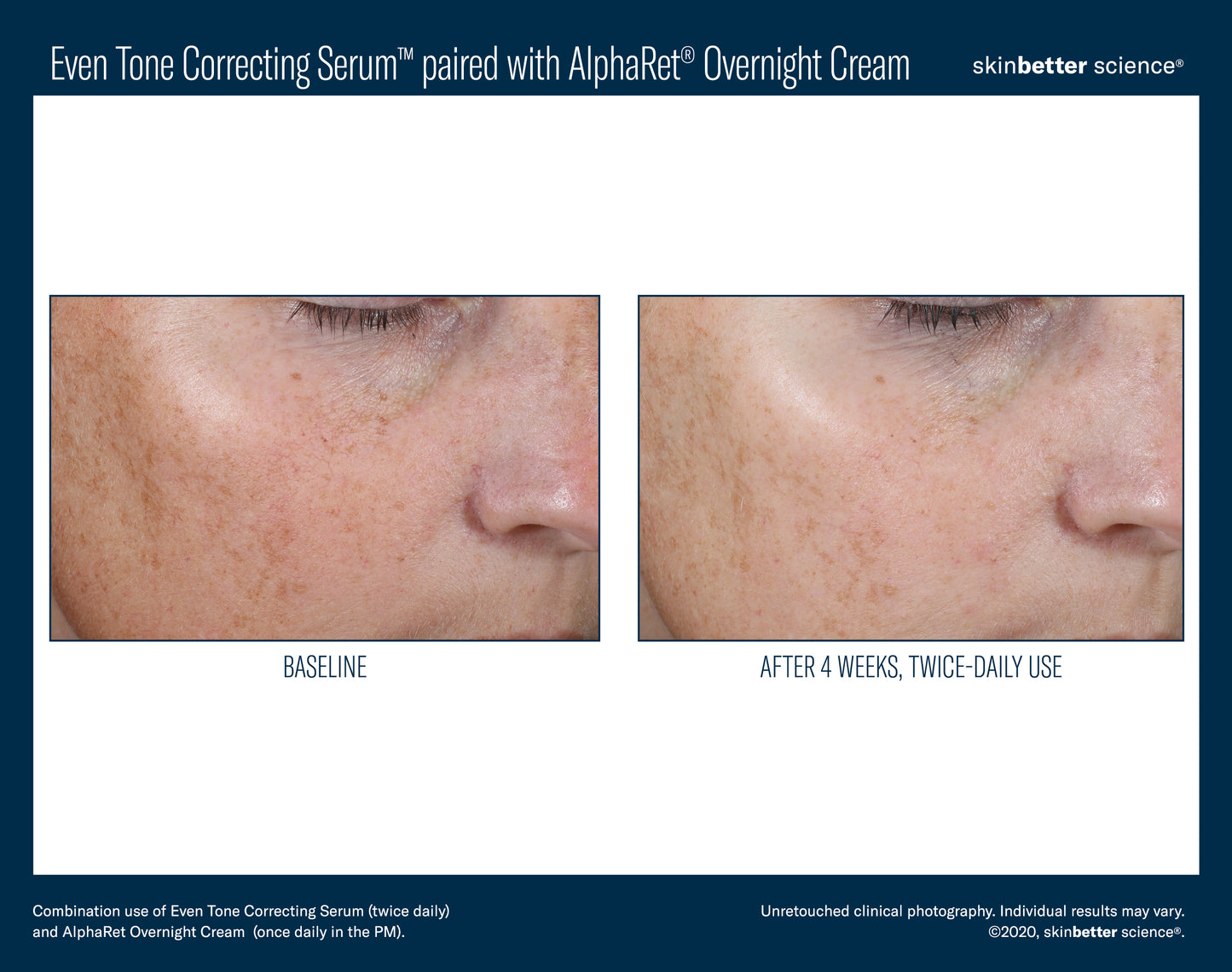 Skinbetter Science Even Tone Correcting Serum (50ml)