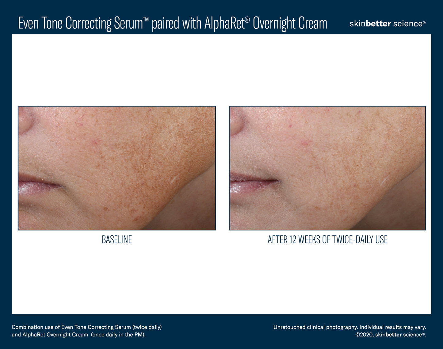 Skinbetter Science Even Tone Correcting Serum (50ml)