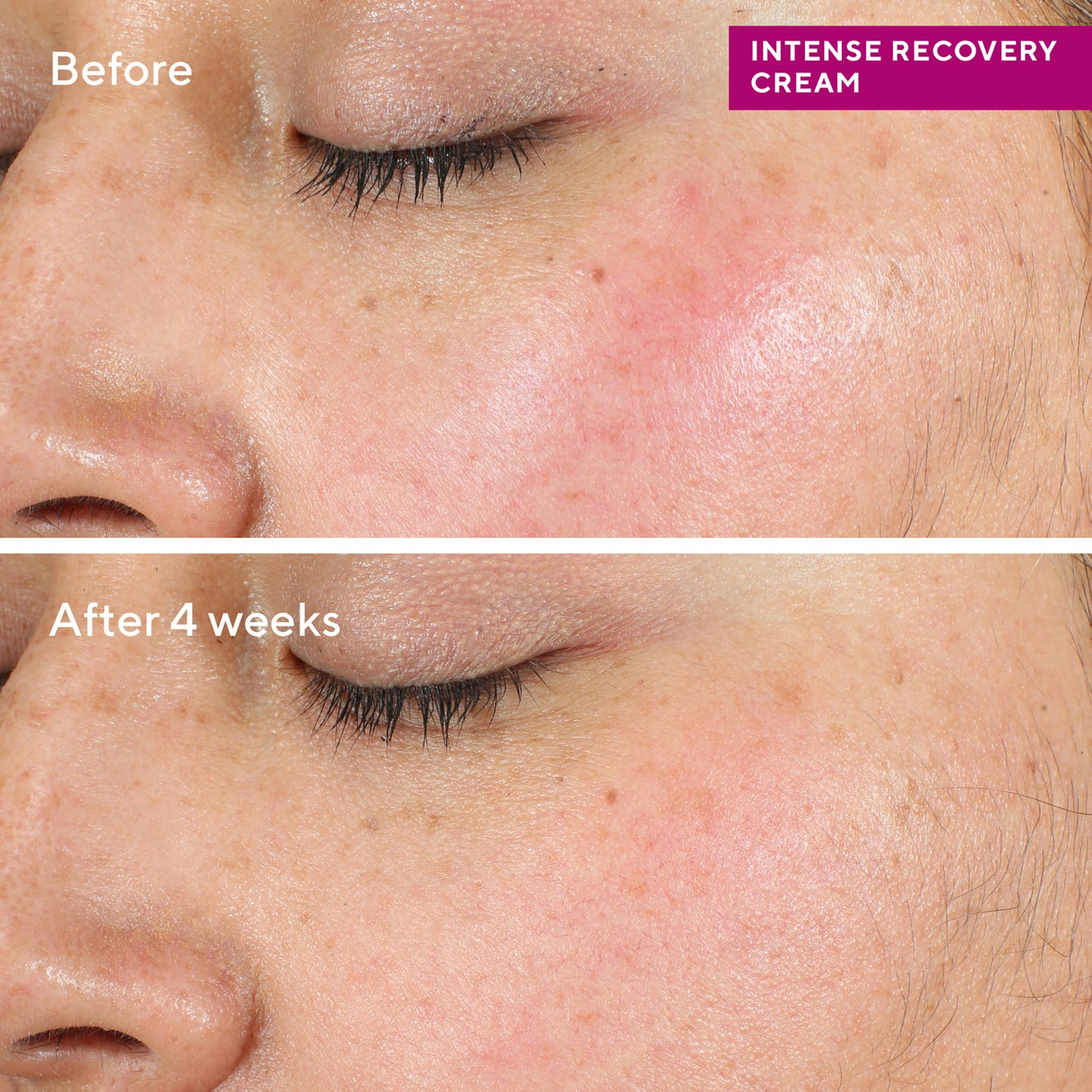 Murad Intense Recovery Cream (50ml)
