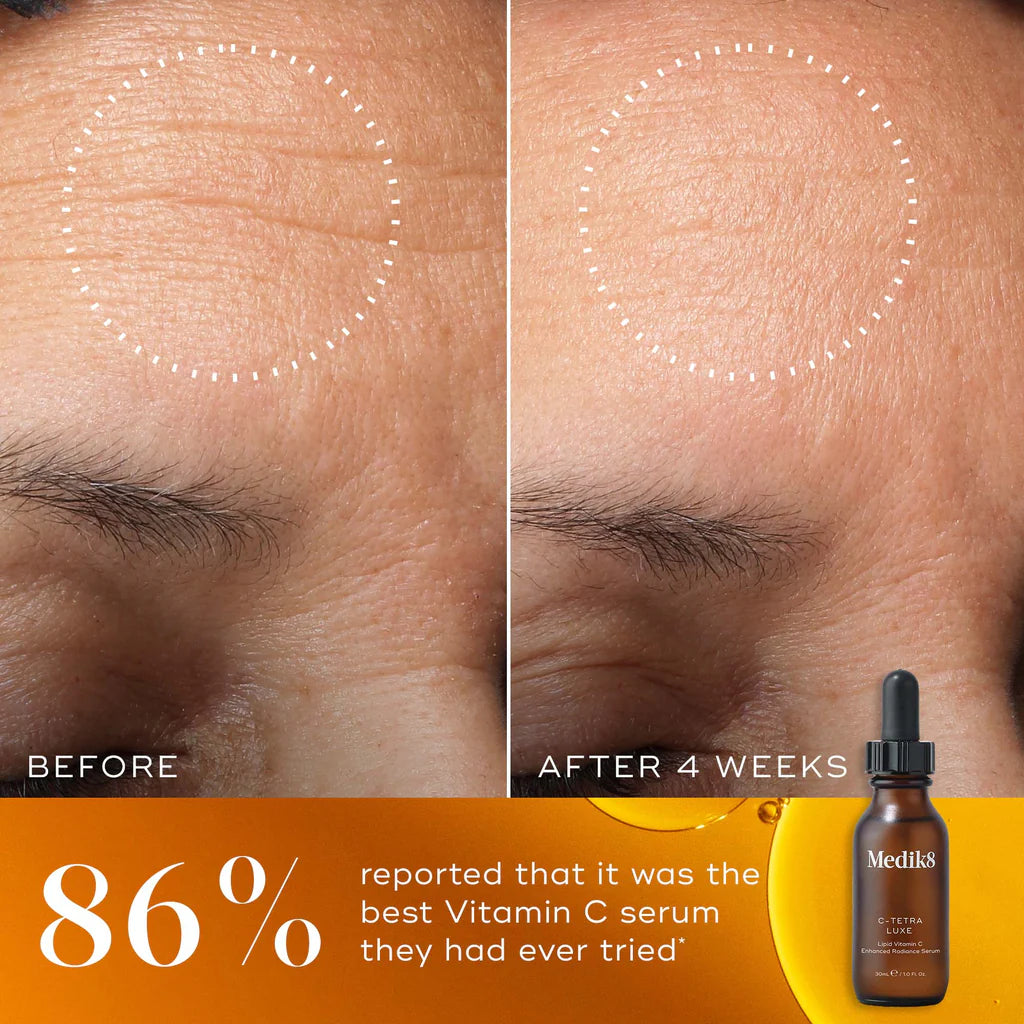 Medik8-c-tetra-luxe-30ml-before-and-after