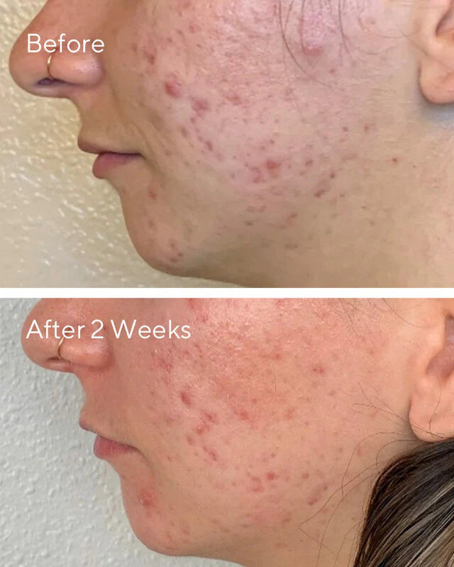 Murad Daily Clarifying Peel (95ml)