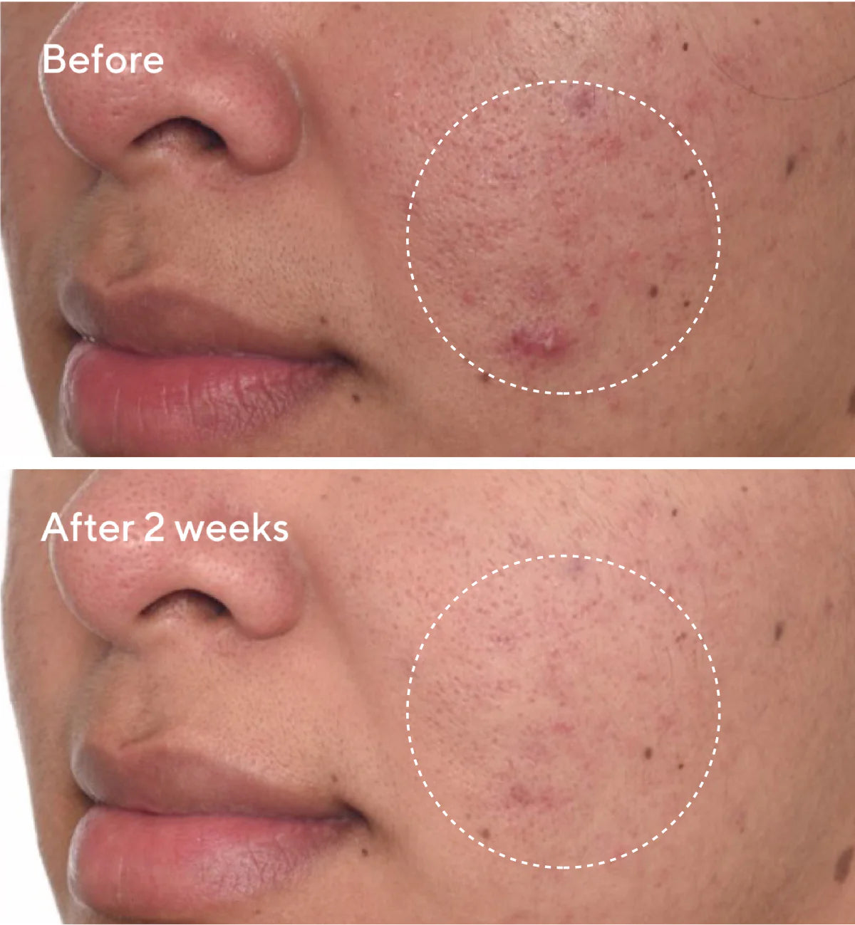 Murad Rapid Dark Spot Correcting Serum (30ml)
