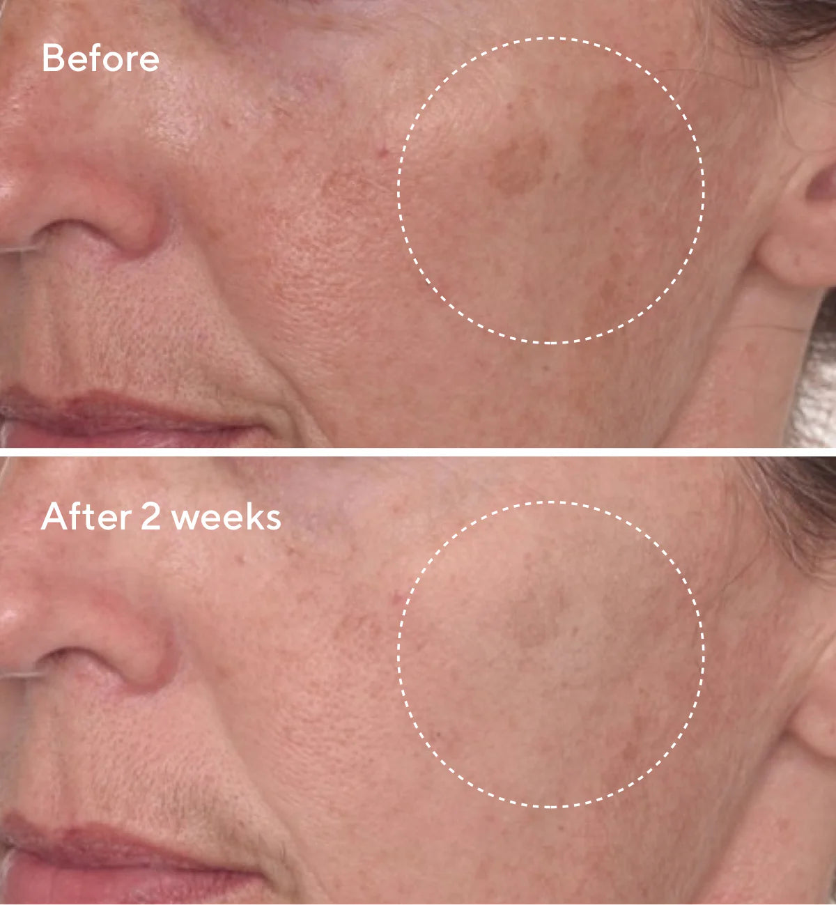 Murad Rapid Dark Spot Correcting Serum (30ml)