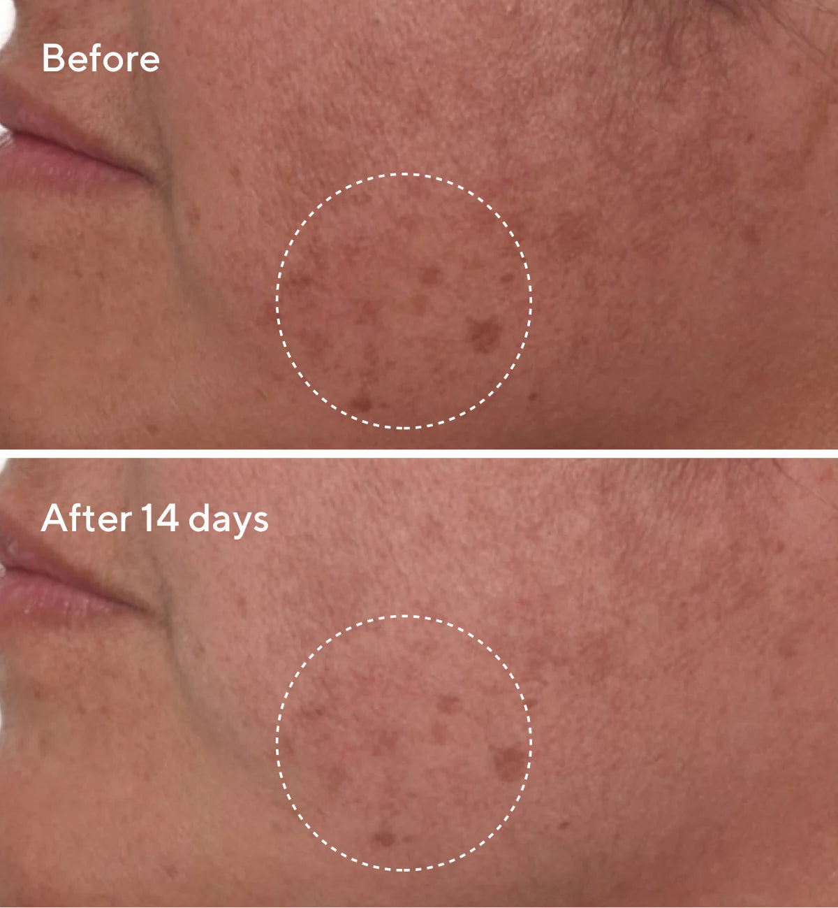 Murad Rapid Dark Spot Correcting Serum (30ml)