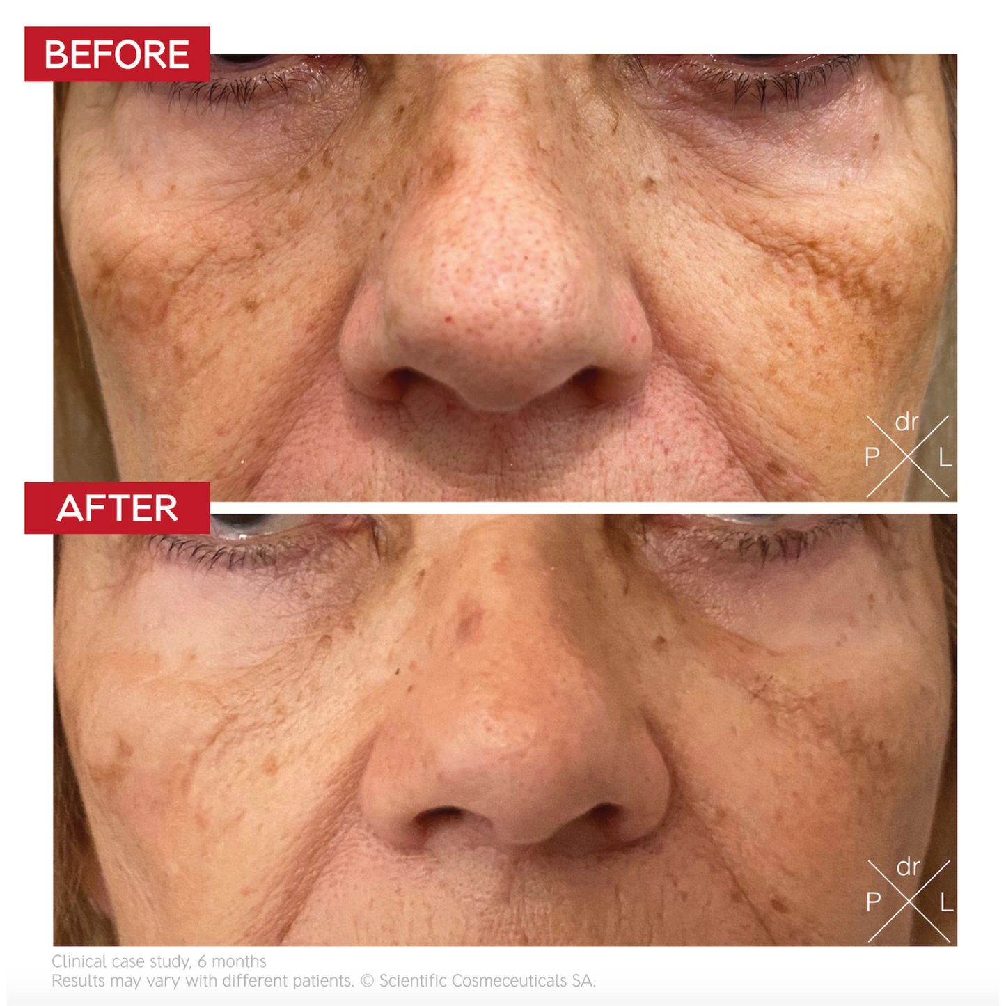 Dr. LEVY Pigment Control Drops (30 ml)