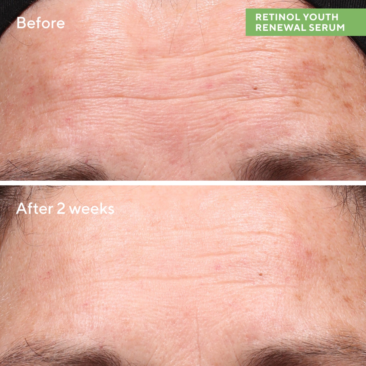 Murad Retinol Youth Renewal Serum (30ml)