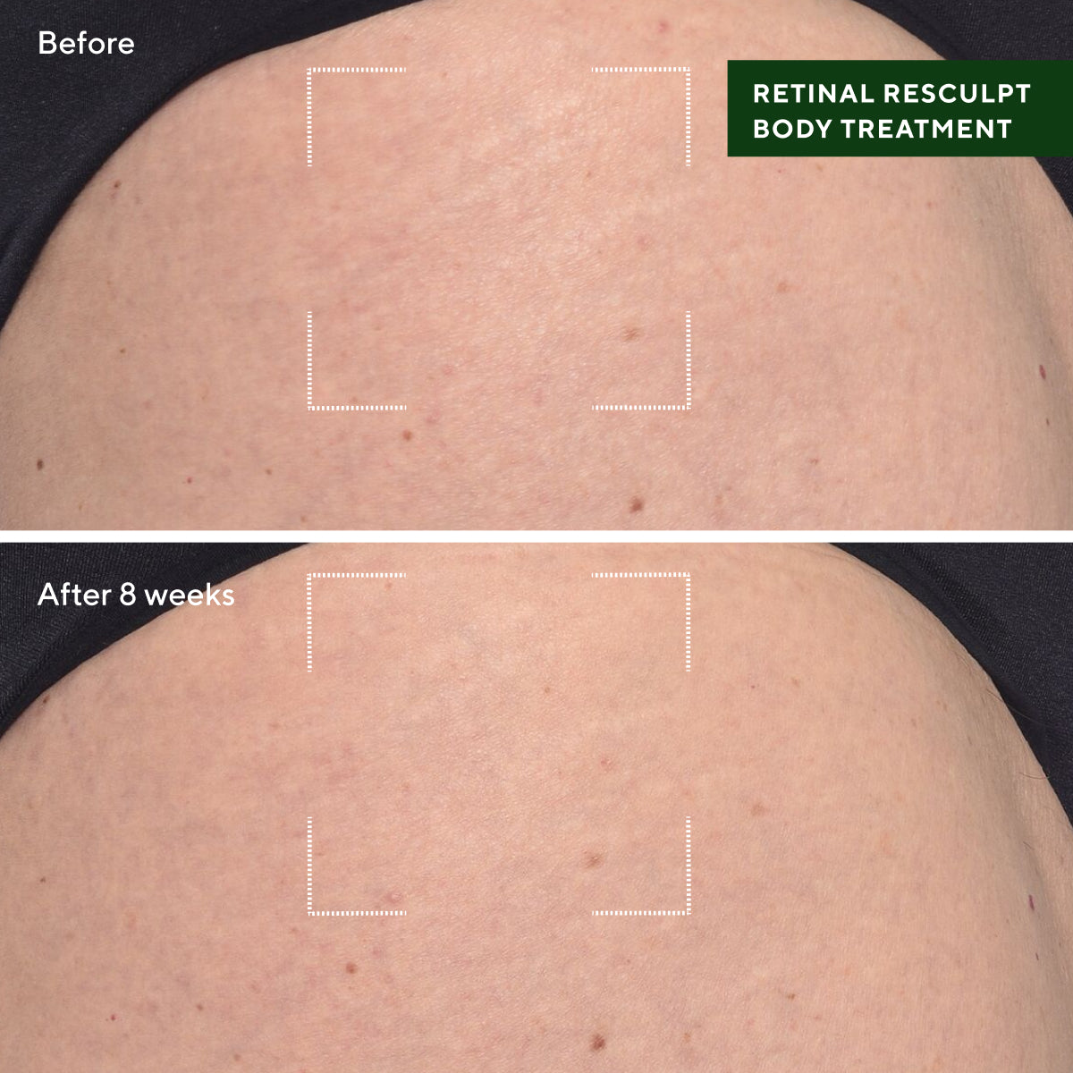 Murad Retinal ReSculpt Body Treatment (148ml)
