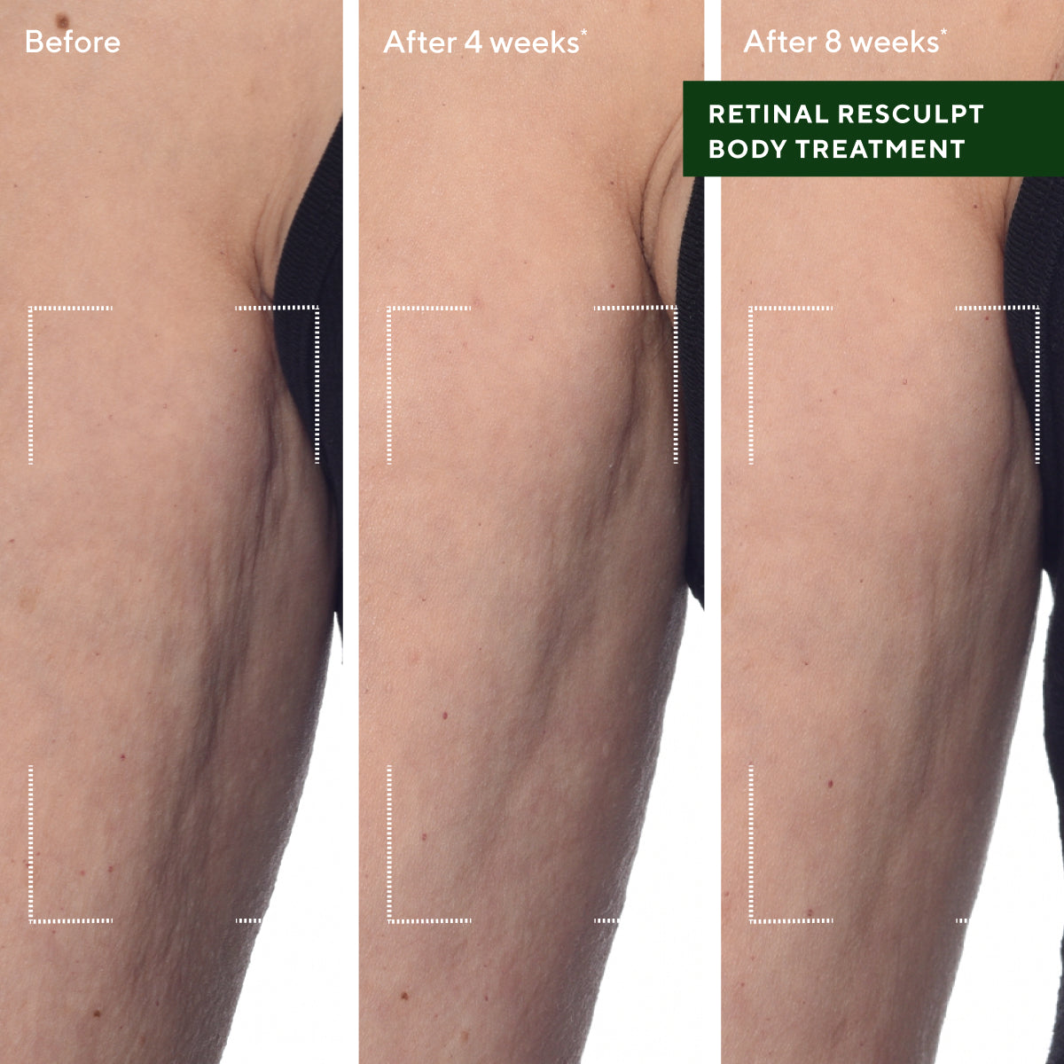 Murad Retinal ReSculpt Body Treatment (148ml)