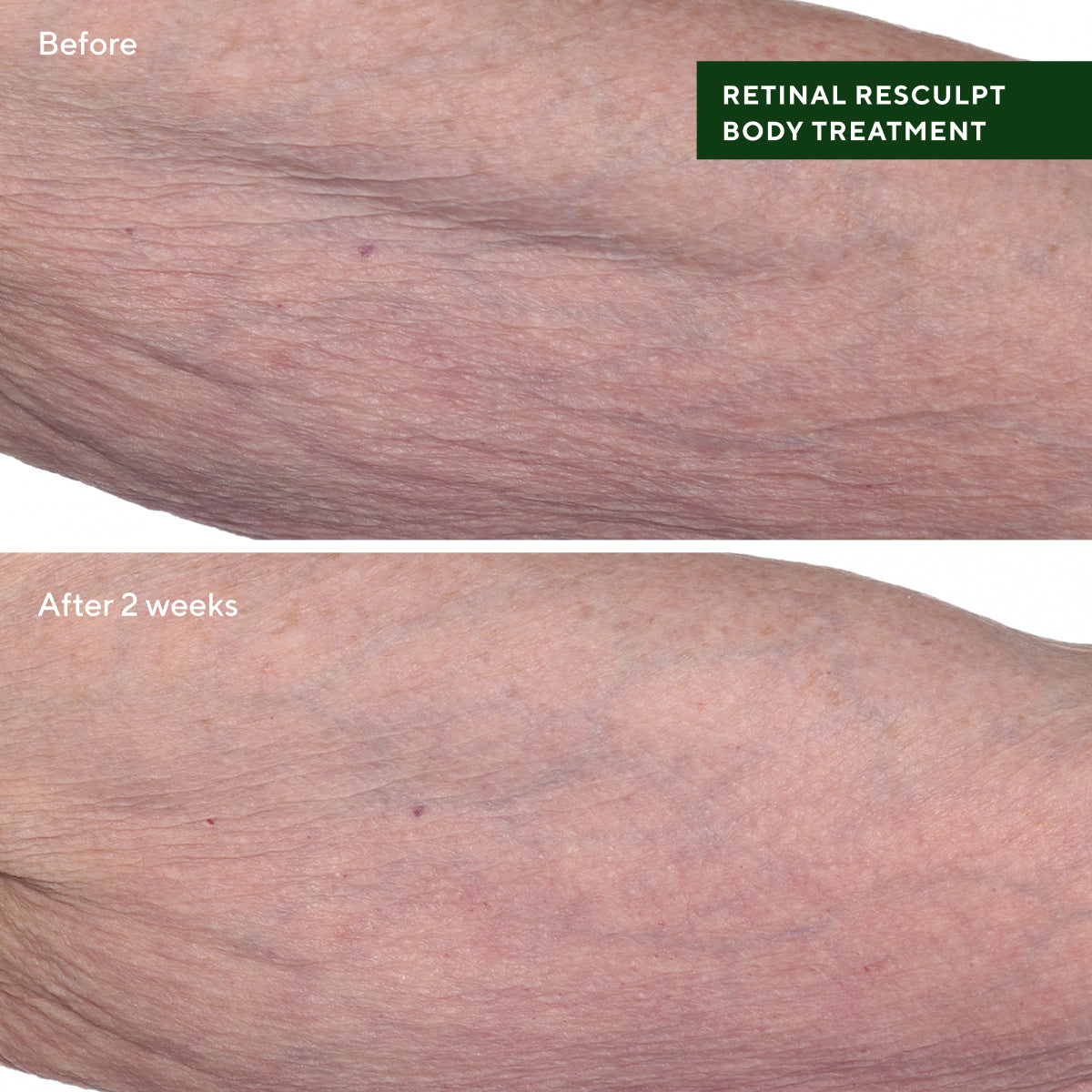 Murad Retinal ReSculpt Body Treatment (148ml)