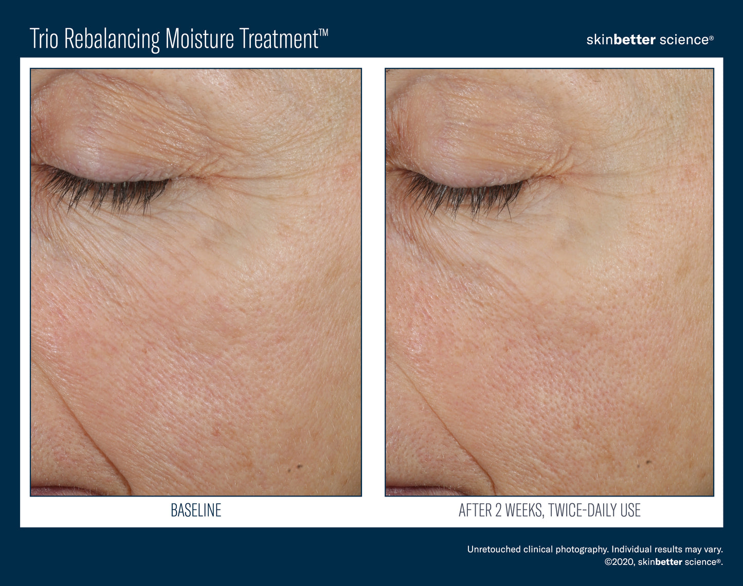 Skinbetter Science Trio Rebalancing Moisture Treatment (50ml)
