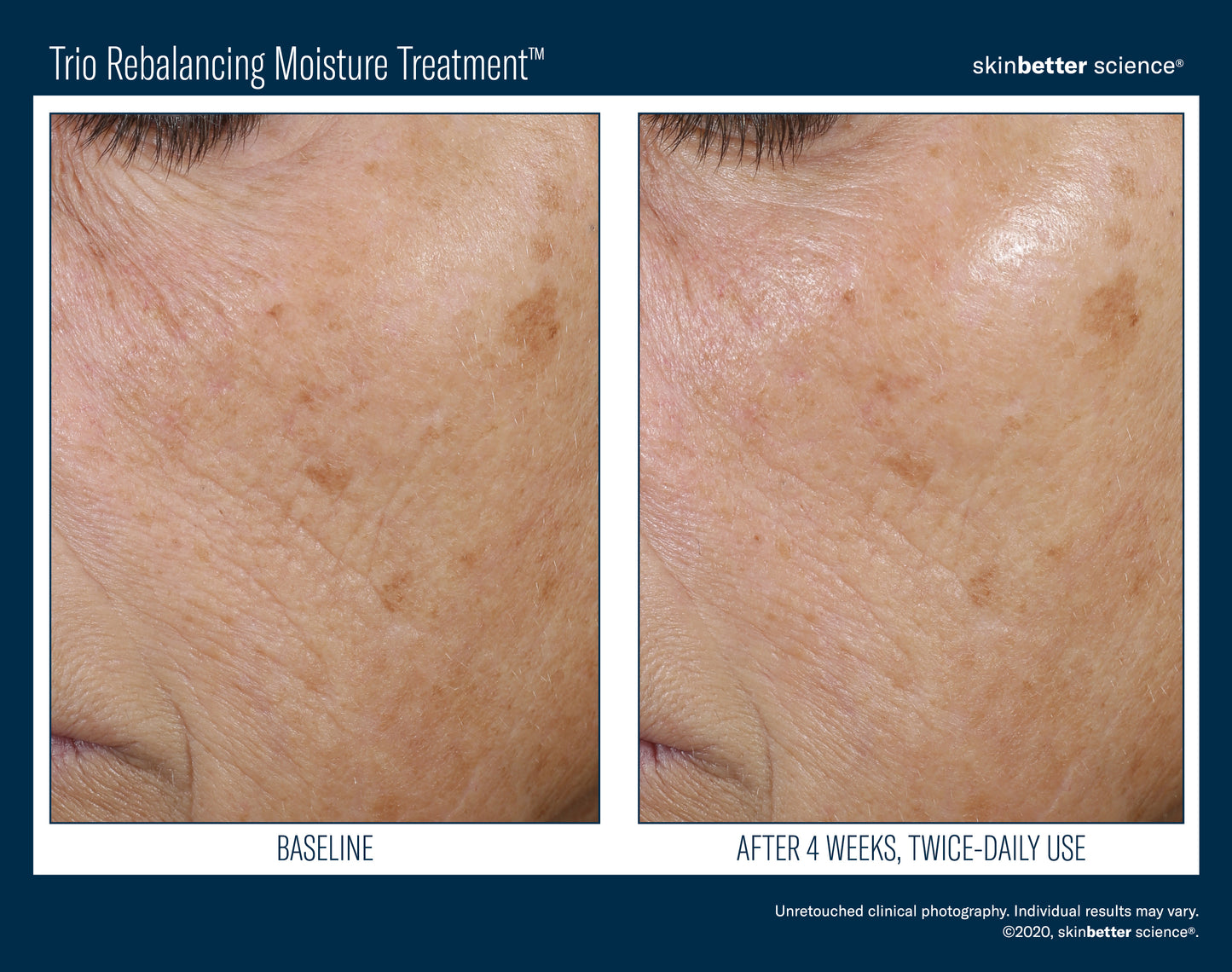 Skinbetter Science Trio Rebalancing Moisture Treatment (50ml)