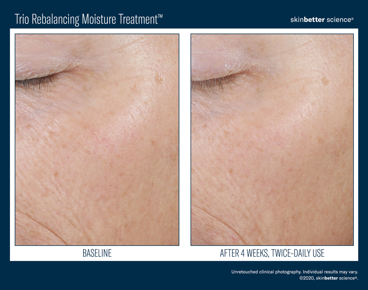 Skinbetter Science Trio Rebalancing Moisture Treatment (50ml)