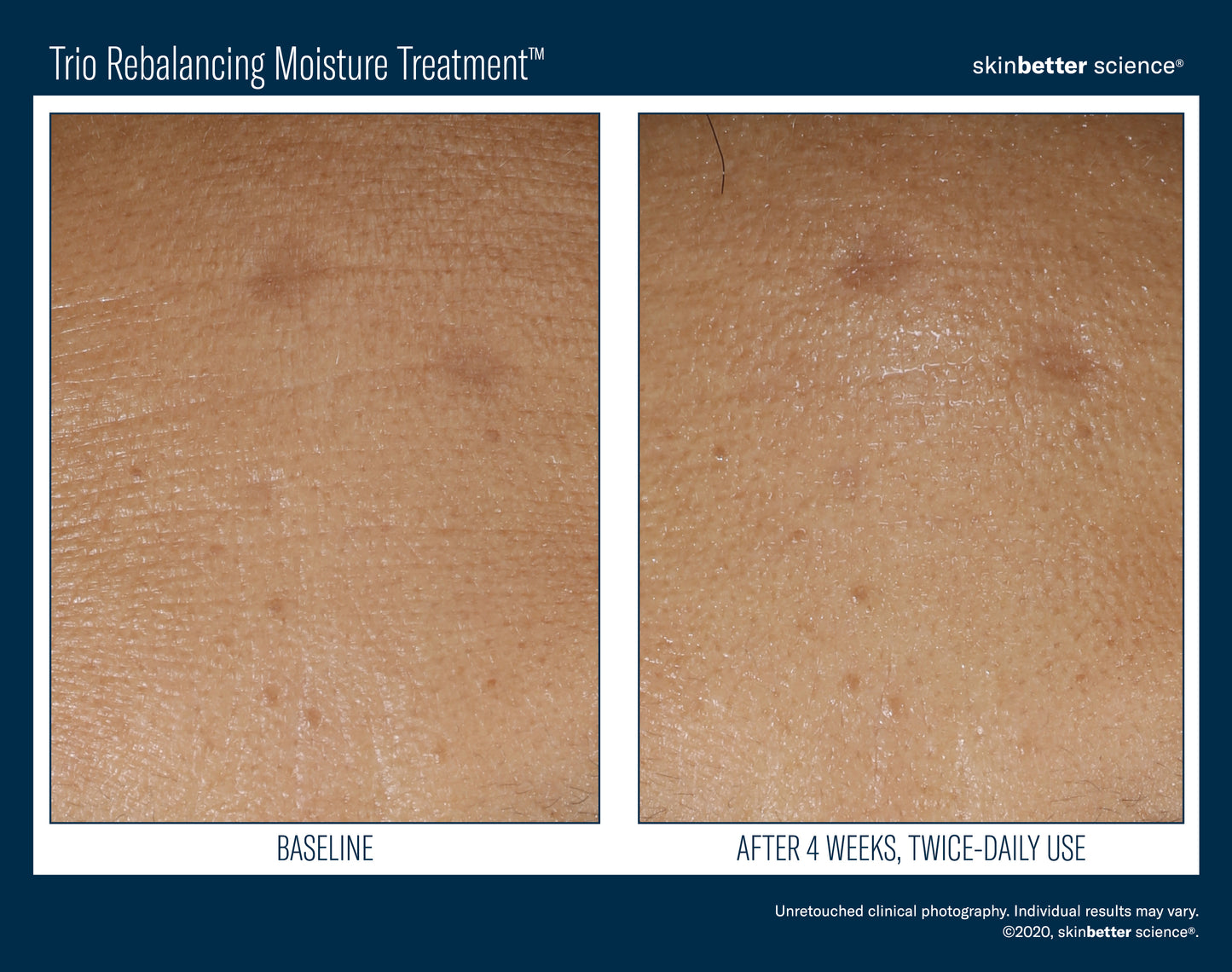 Skinbetter Science Trio Rebalancing Moisture Treatment (50ml)