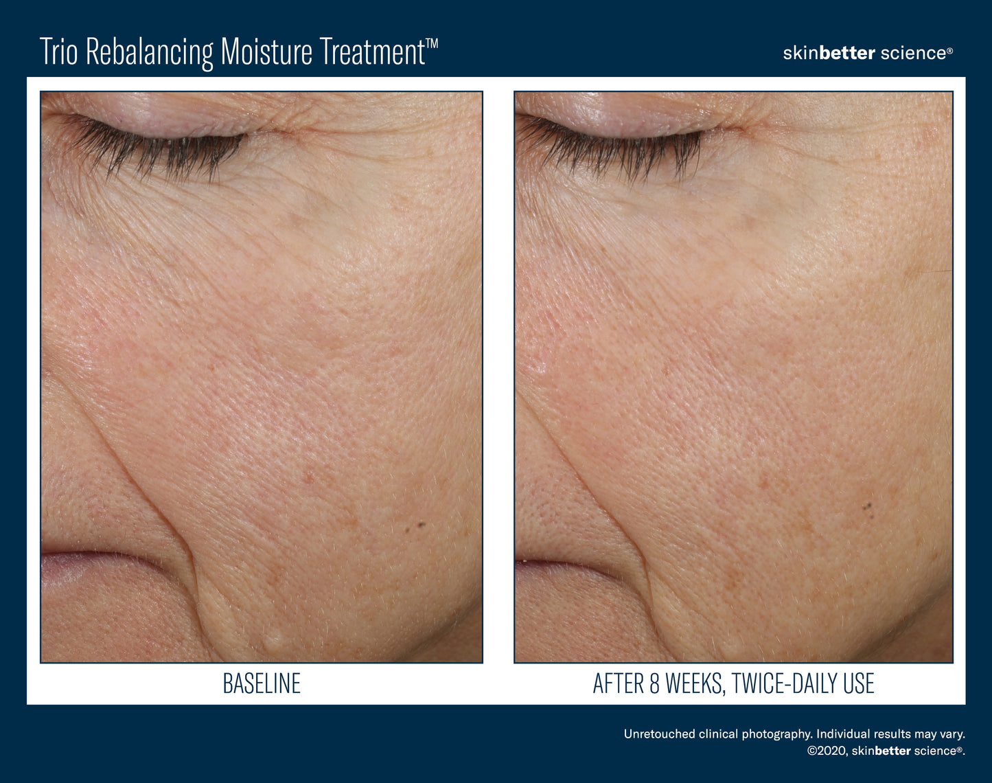 Skinbetter Science Trio Rebalancing Moisture Treatment (50ml)