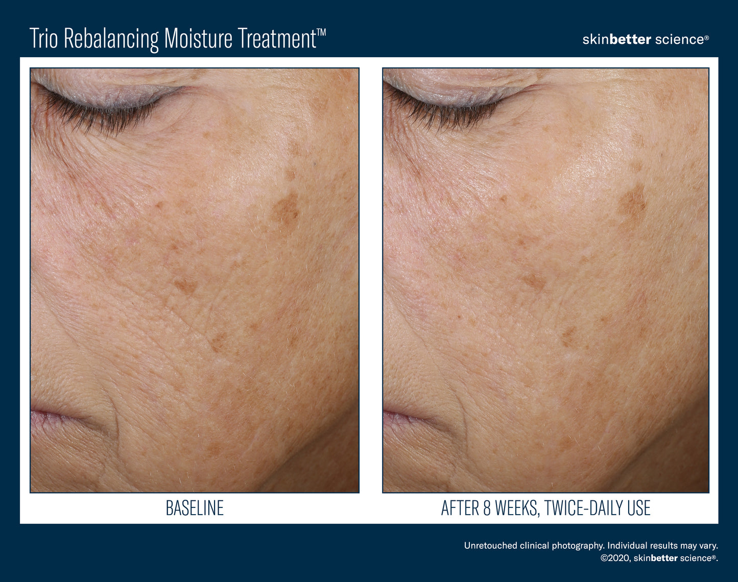 Skinbetter Science Trio Rebalancing Moisture Treatment (50ml)