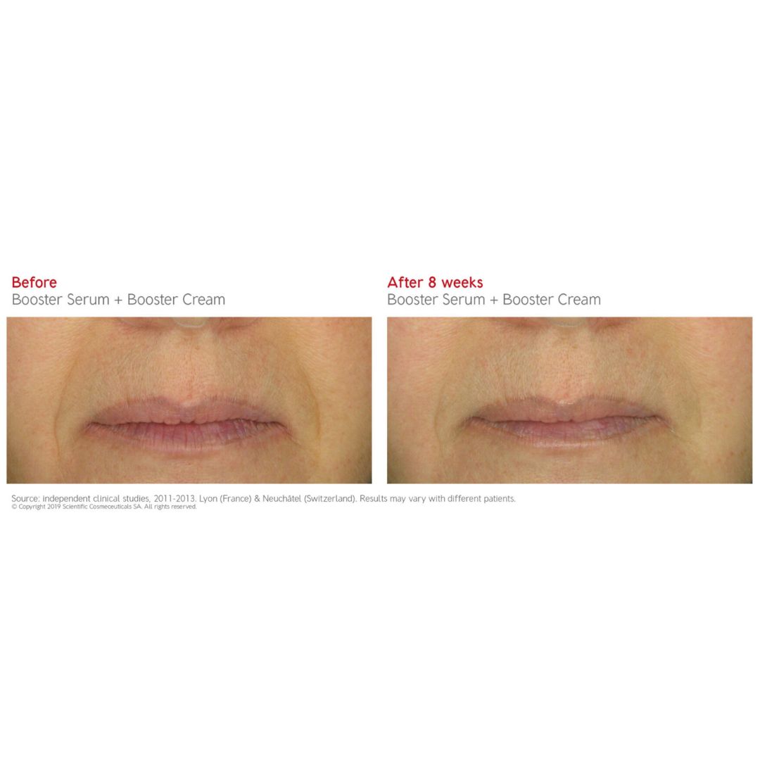 Dr. Levy BOOSTER CREAM (50ml)