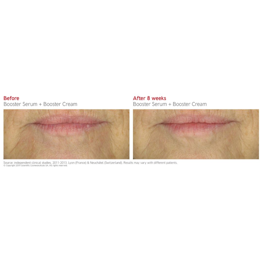 Dr. Levy BOOSTER CREAM (50ml)