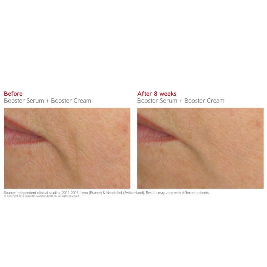 Dr. Levy BOOSTER CREAM (50ml)