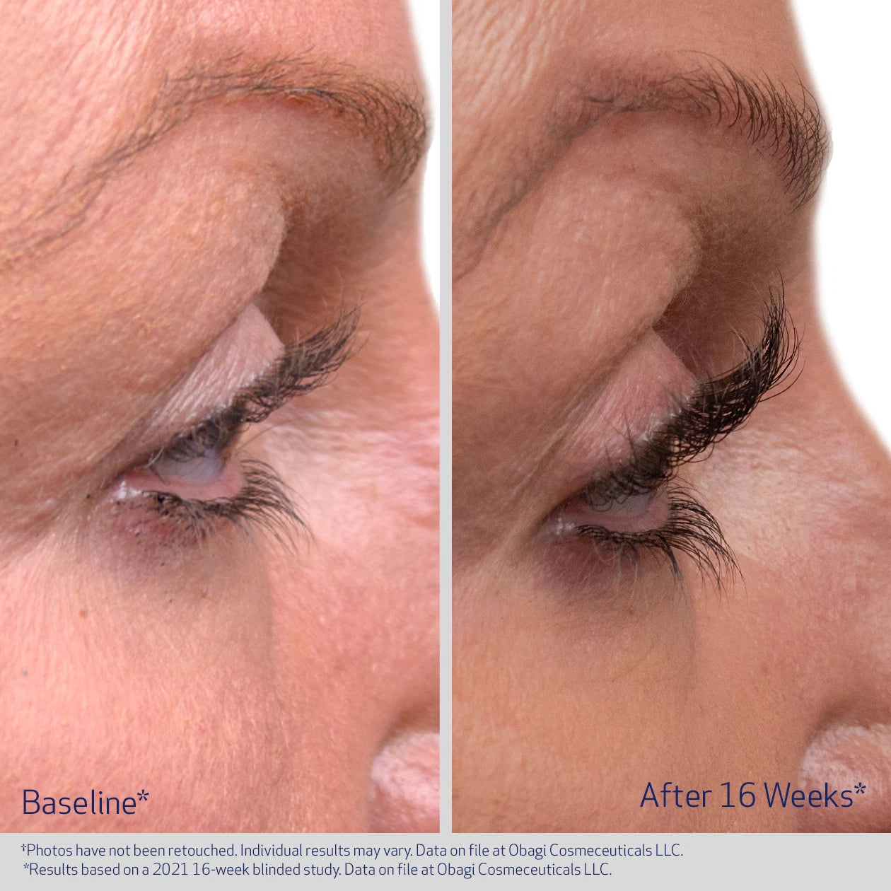 Obagi Nu-Cil™ Eyelash Enhancing Serum (3ml)