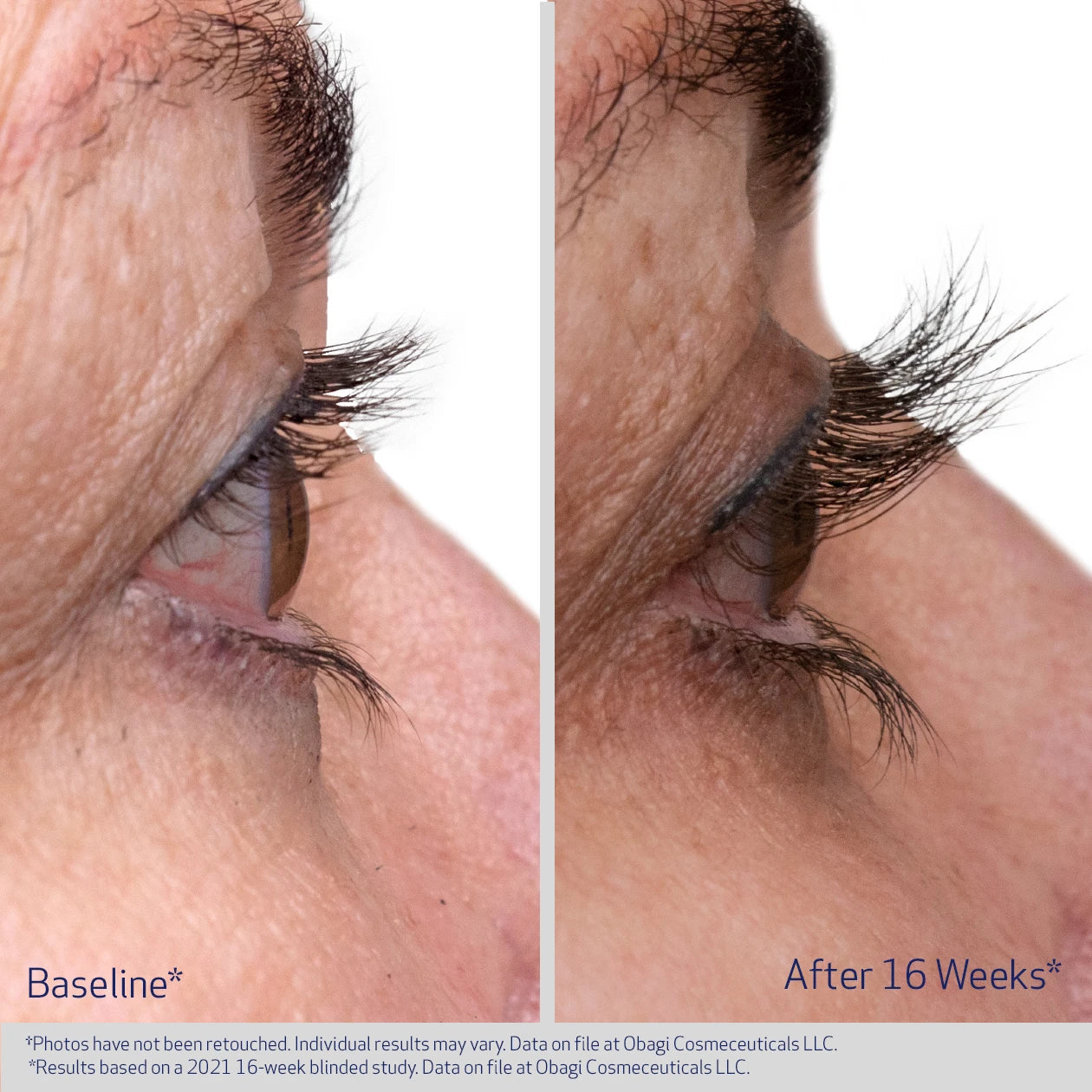 Obagi Nu-Cil™ Eyelash Enhancing Serum (3ml)