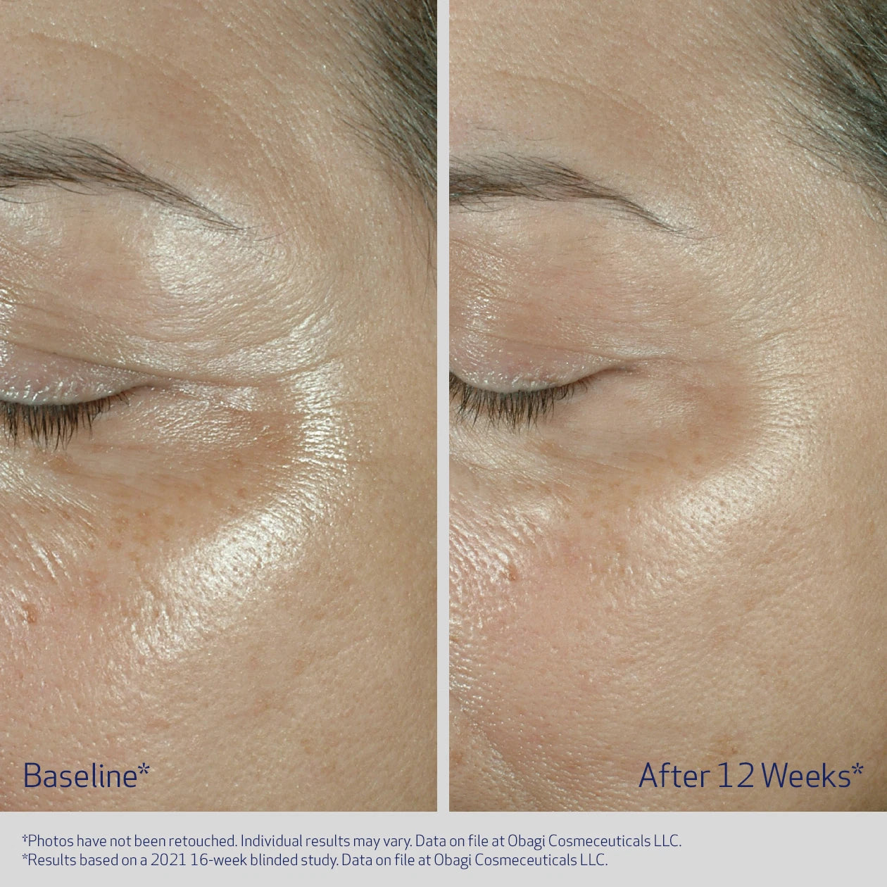 Obagi ELASTIderm Eye Cream (15g)