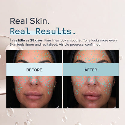 ALUMIER INTELLIRET™ 0.3+ (30ml)