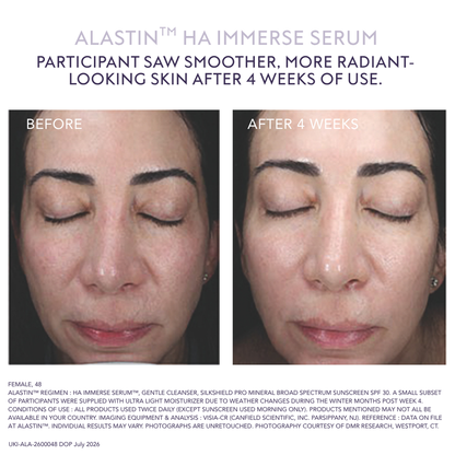 Alastin HA (Hyaluronic Acid) IMMERSE Serum (30ml)