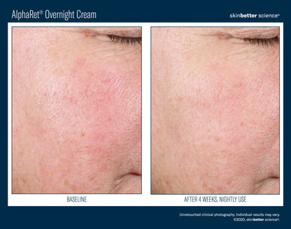 Skinbetter Science AlphaRet Overnight Cream
