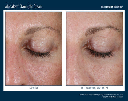 Skinbetter Science AlphaRet Overnight Cream