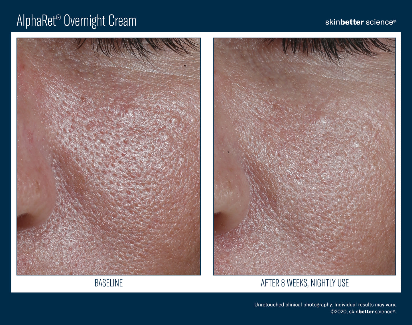 Skinbetter Science AlphaRet Overnight Cream