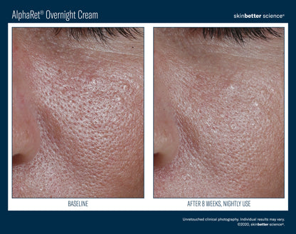 Skinbetter Science AlphaRet Overnight Cream