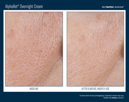 Skinbetter Science AlphaRet Overnight Cream