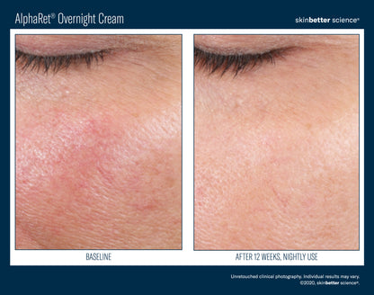 Skinbetter Science AlphaRet Overnight Cream