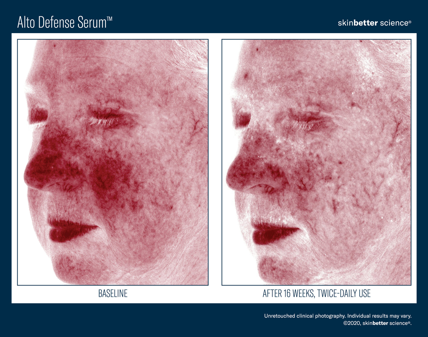 Skinbetter Science Alto Defense Serum (30ml)