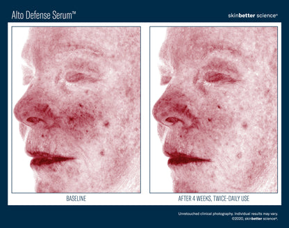 Skinbetter Science Alto Defense Serum (30ml)
