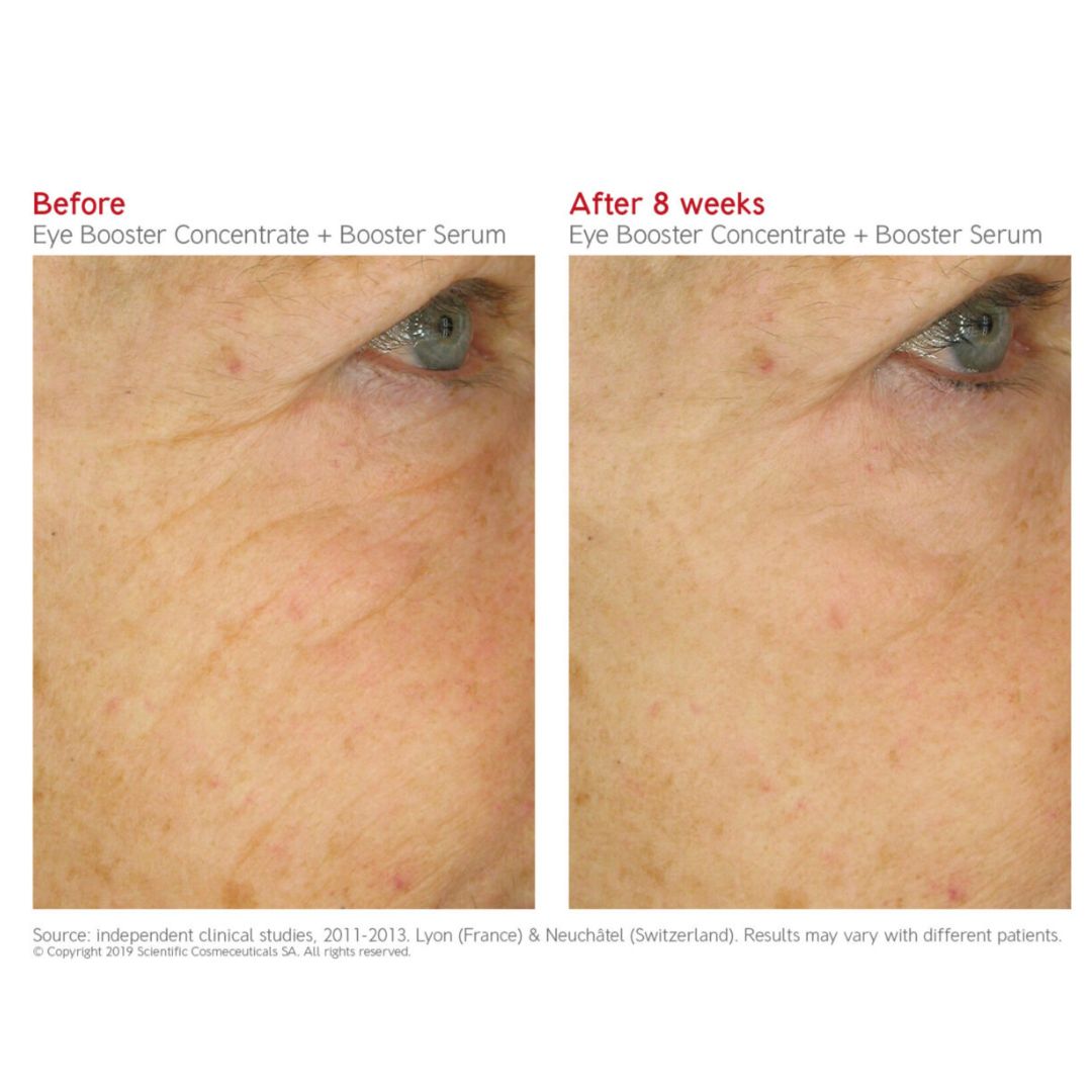 Dr. LEVY EYE BOOSTER CONCENTRATE (15ML)