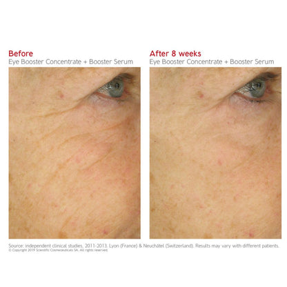 Dr. LEVY EYE BOOSTER CONCENTRATE (15ML)