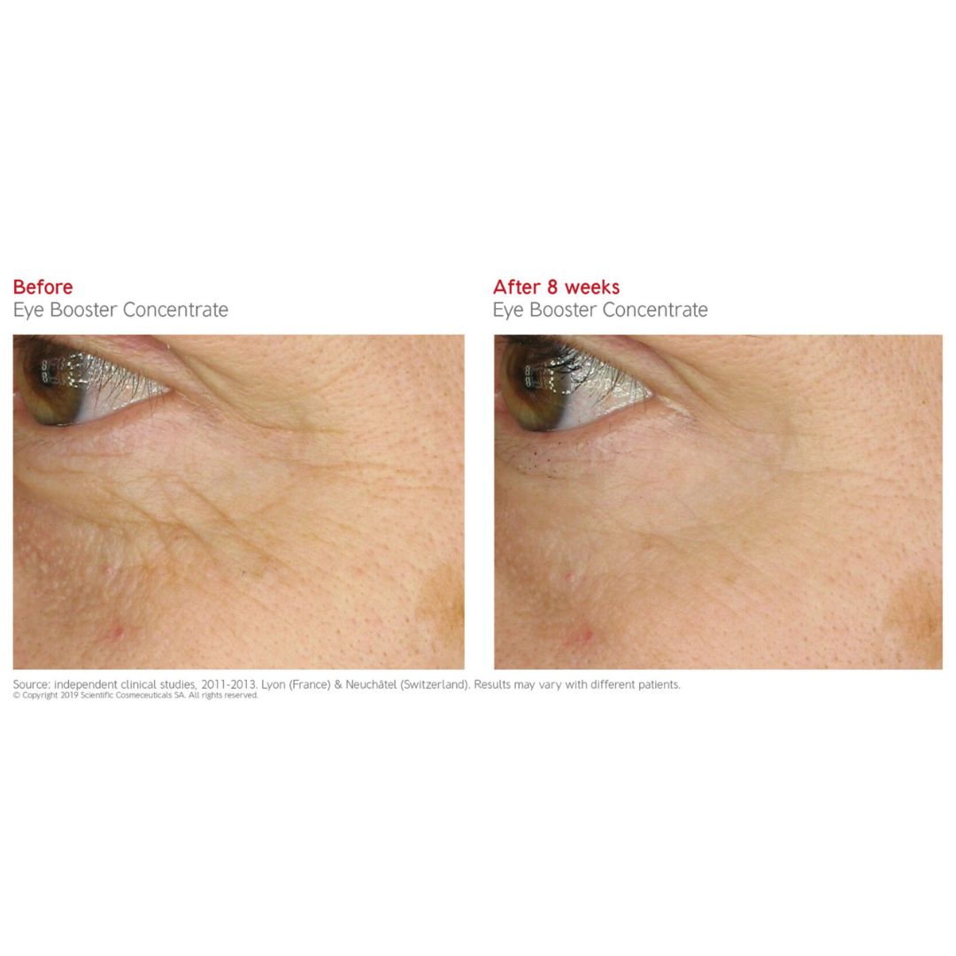Dr. LEVY EYE BOOSTER CONCENTRATE (15ML)