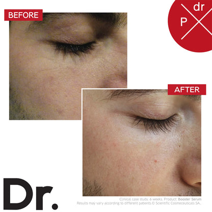 Dr. LEVY Booster Serum (30ml)